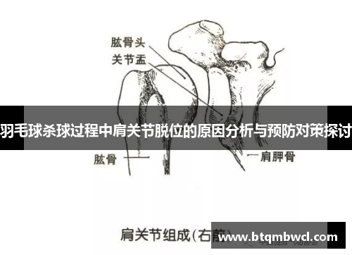 羽毛球杀球过程中肩关节脱位的原因分析与预防对策探讨